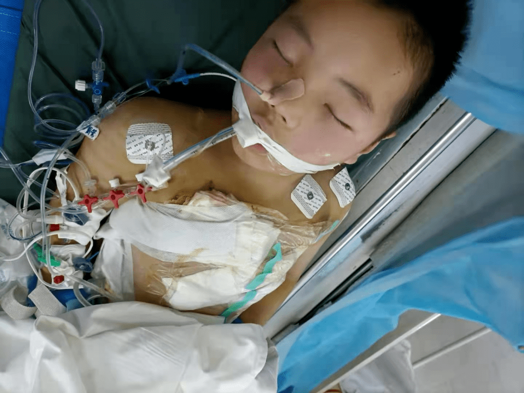 女童頭上插刀淡定就醫(yī)，醫(yī)生巧妙取刀，網(wǎng)友，這是怎樣的心理素質(zhì)？