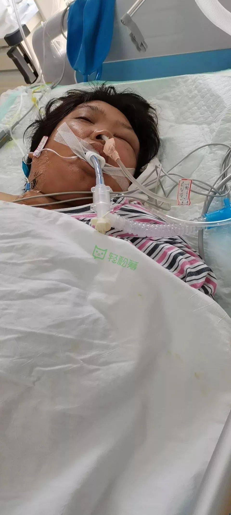 6歲娃沙灘光腳踩到死魚(yú)，不幸進(jìn)了ICU！家長(zhǎng)該如何防范？