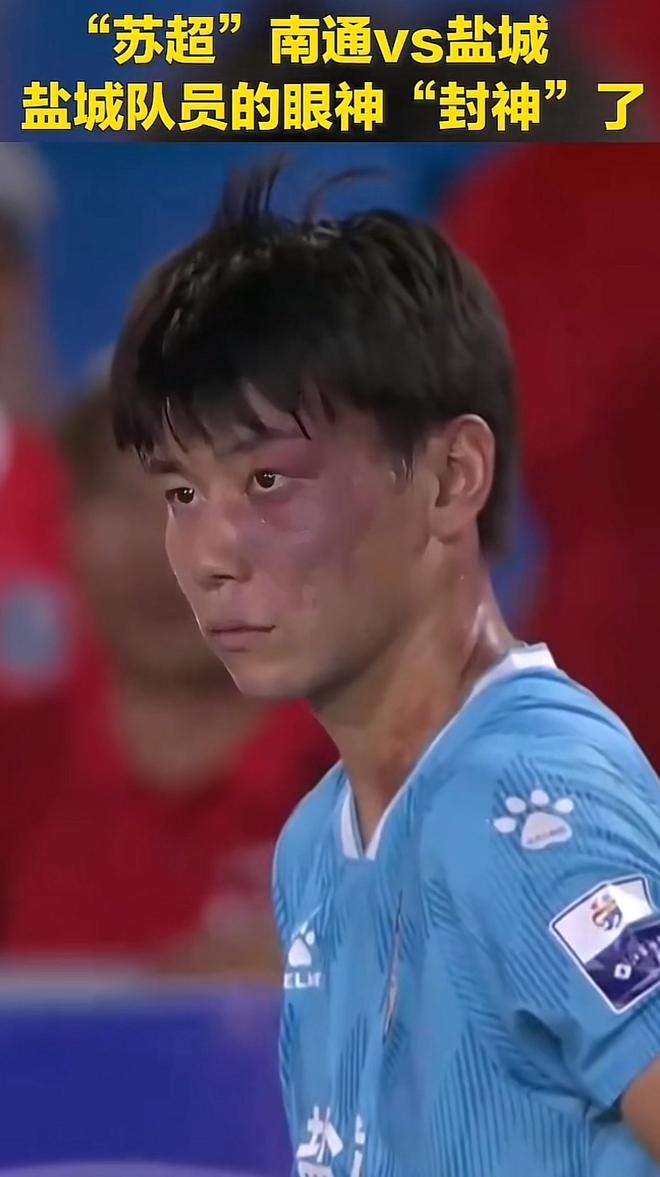 蘇超鹽城隊(duì)龐智超談青面獸昵稱，志在拼搏，青面雄心