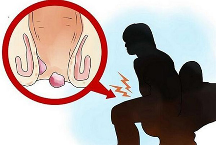 曹赟定觀察，斯盧茨基攬責(zé)背后的微妙心態(tài)與去年痔瘡困擾的隱喻